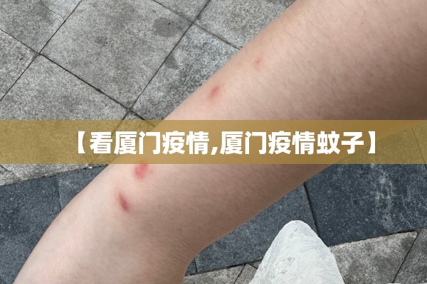 【云南长水机场疫情,云南长水机场防疫】