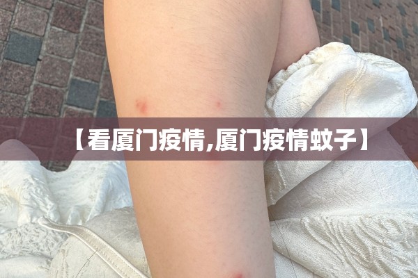 【看厦门疫情,厦门疫情蚊子】
