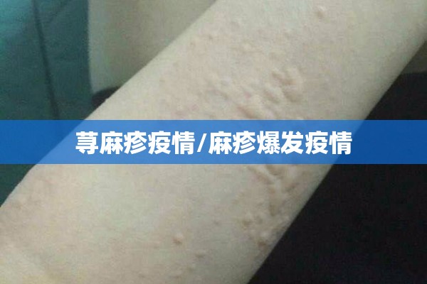 疫情防控体系:疫情防控体系包括
