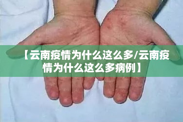 镍矿期货实时行情走势图:镍矿期货价格走势
