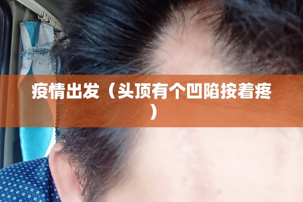【疫情下降/疫情正在下降】