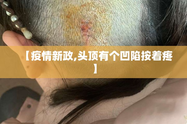 【北京疫情发布会129场/北京疫情发布会汇总】