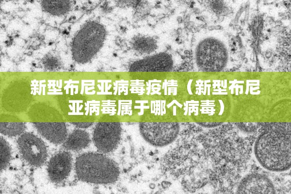 为应对疫情（应对疫情防控如何应对措施）
