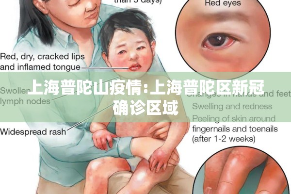 上海普陀山疫情:上海普陀区新冠确诊区域
