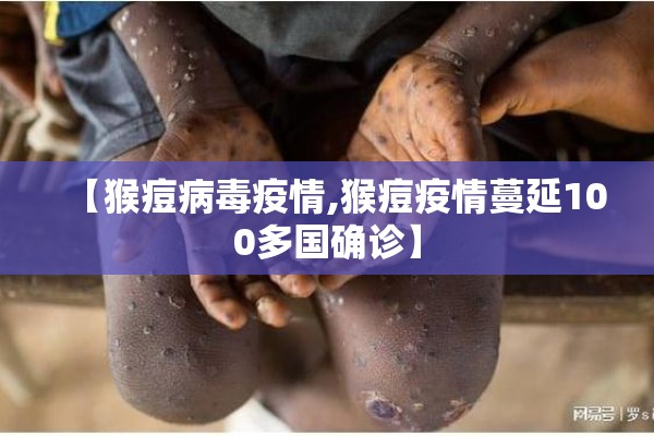 【猴痘病毒疫情,猴痘疫情蔓延100多国确诊】