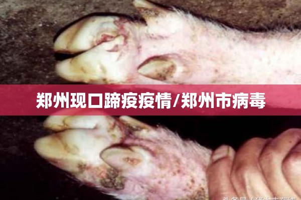 【疫情防控十项要求/疫情防控十大措施】