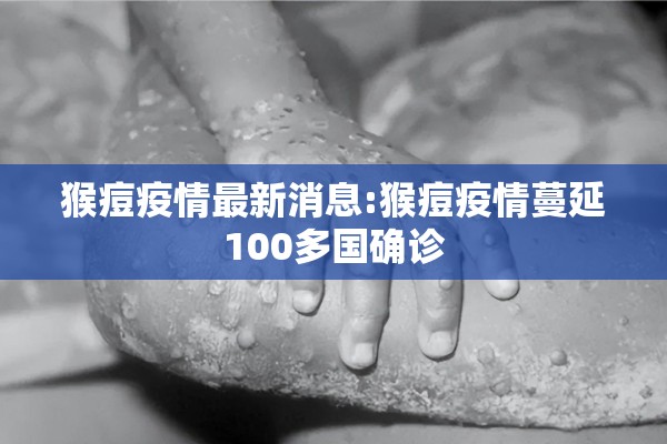 猴痘疫情最新消息:猴痘疫情蔓延100多国确诊 猴痘疫情最新消息:猴痘疫情蔓延100多国确诊